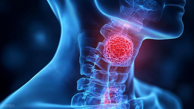 如何预防食管癌手术后的并发症？