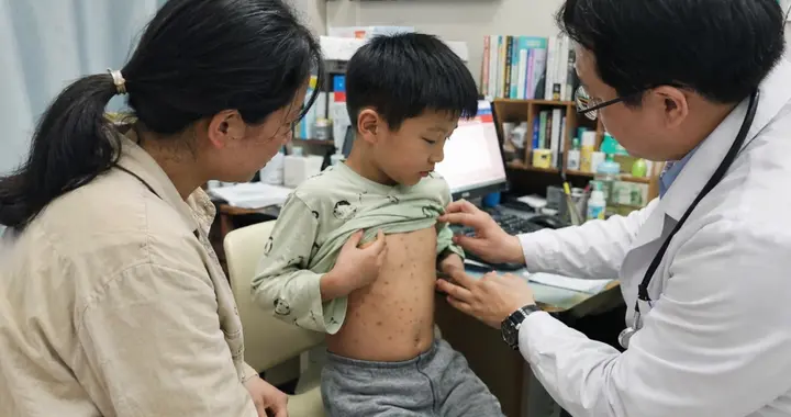 9岁男孩感染水痘，13天后小脑炎走了，妈妈崩溃痛哭：是我害了你