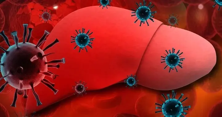 晚期原发性肝癌精准治疗的新路径 2025法国基因组医学计划结果发布