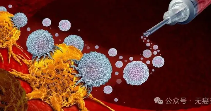 15万一针的癌症疫苗值吗？个性化DC疫苗如何成为“癌细胞狙击手”
