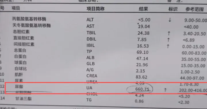 体检报告上这个指标偏高，可能是“高尿酸警报”，很多人都忽略了