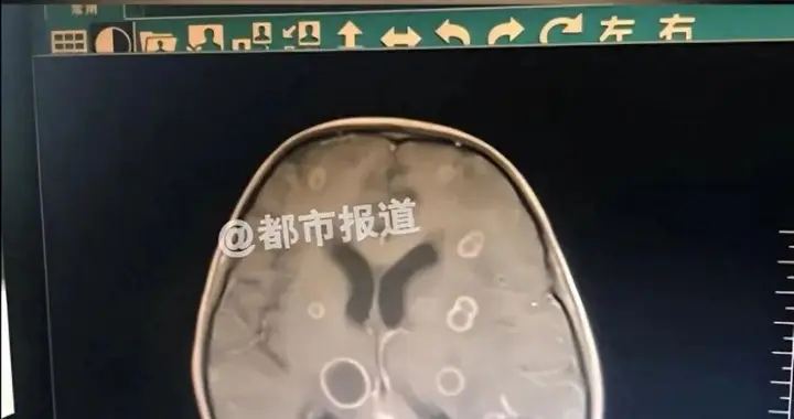 这种致癌物藏在家里，很多人天天接触，却浑然不知！