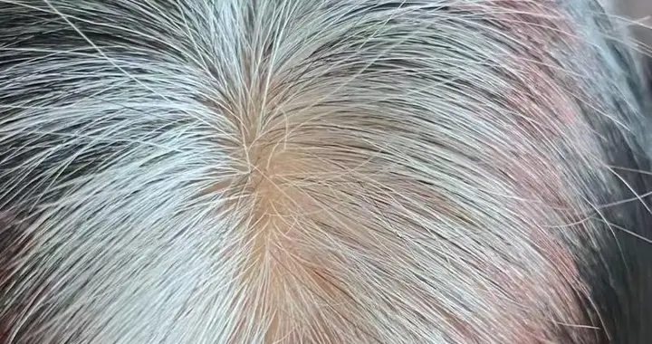 别再瞎补了！白发能不能变黑就看这一点