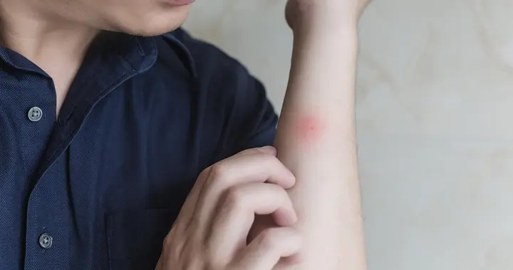 身体出现这几处瘙痒，小心是艾滋病！