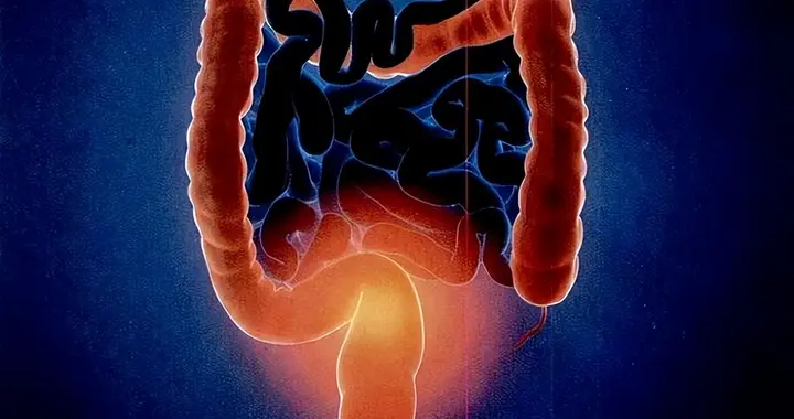 大肠癌正盯上年轻人，7类高危人群做好预防，早期肠镜筛查是关键