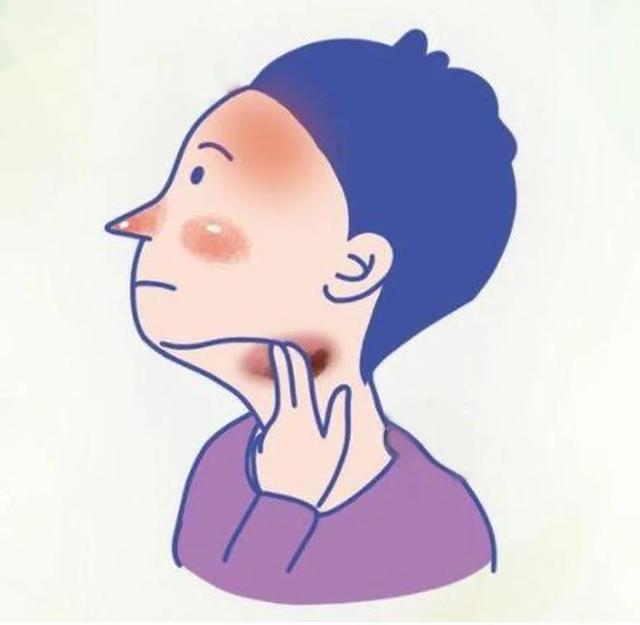 盗汗半年，误把淋巴瘤当作更年期！医生：多留意这些身体信号