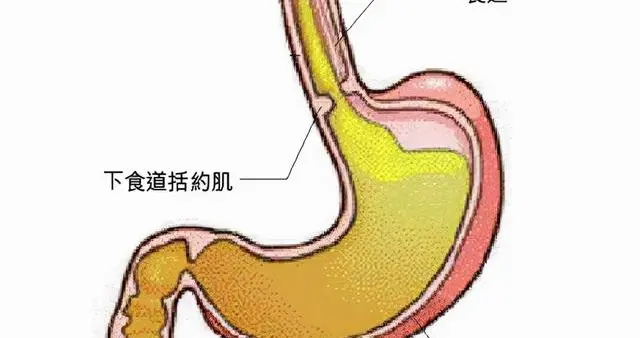 慢性胃炎患者饮食注意事项有哪些？
