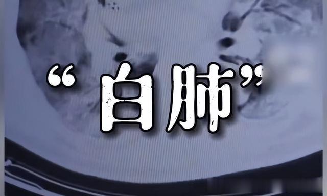 为什么会出现白肺？这4类人要高度警惕白肺！