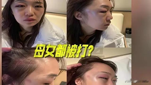 米粒儿：又是一起家暴事件 每次看到我都会