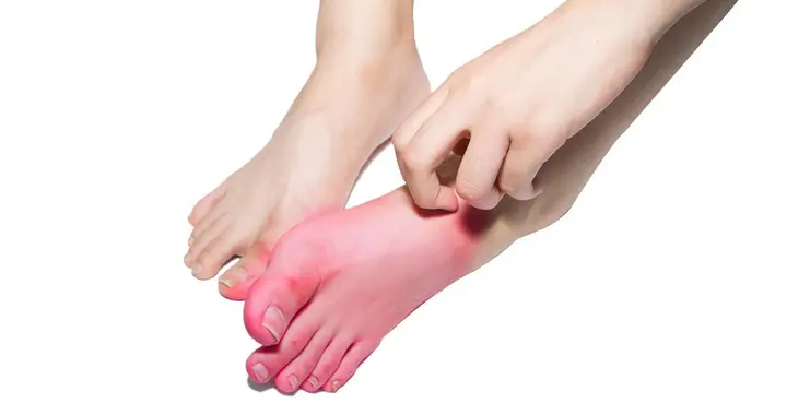 顽固疼痛新克星！利用先进成膜术，祛除风湿更彻底，老伤老痛都管