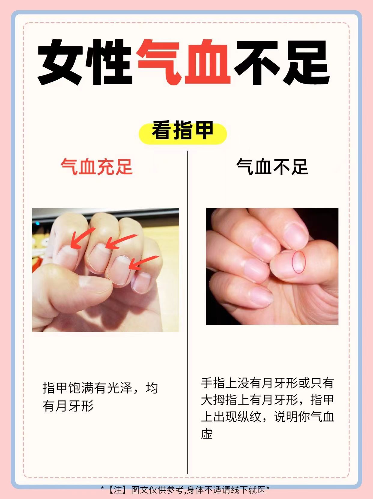 气血不足的表现！