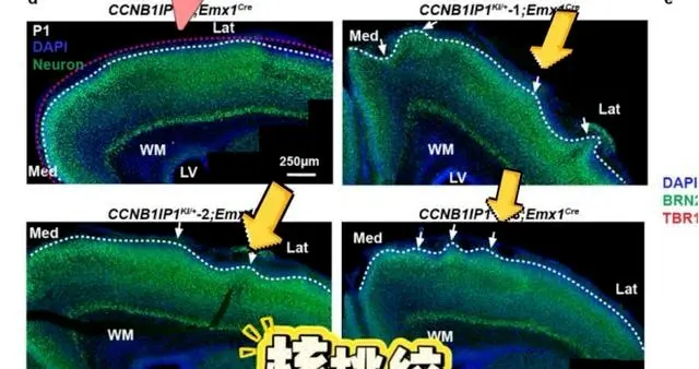 重磅！中国科学院取得重大科研突破——发现人类超高智力关键基因