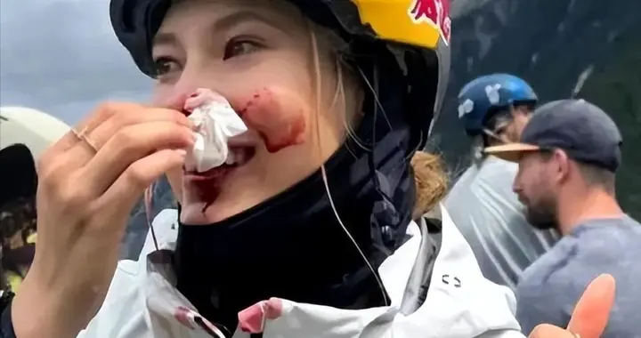 谷爱凌脑出血险丧命！休克5分钟伴癫痫，母亲哭诉：差点醒不来