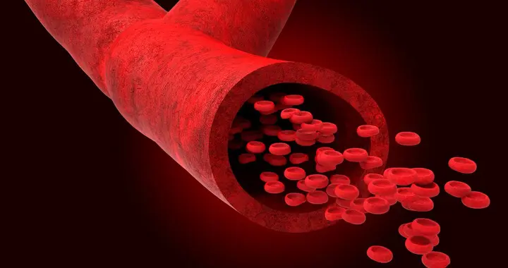 多名医生呼吁高血压患者停止食用，比甜食还粘血管，趁早撤下餐桌