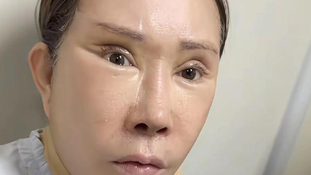 湖光散人：皱纹是没了，但总觉得哪里不对劲