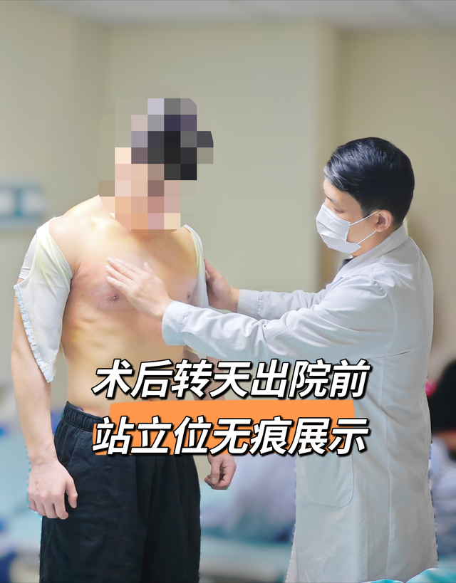 健身爱好者的隐忧：胸部腺体突出与对无痕手术的期待