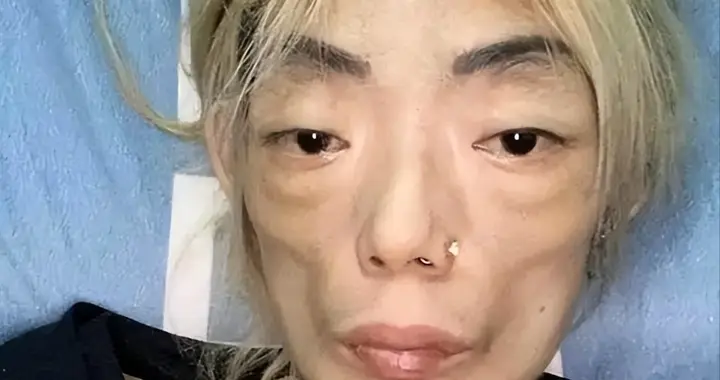 一代女神沦为豪门玩物：结婚8年牙齿全掉，器官切除，面似骷髅