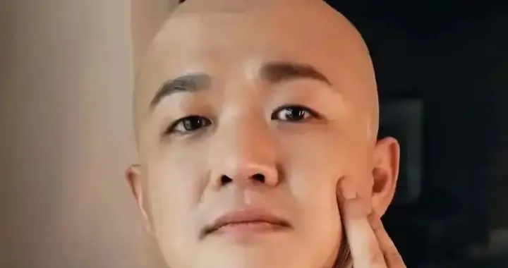 包贝尔自曝打肉毒翻车！脸僵到演不了生气，网友：这长相真没必要