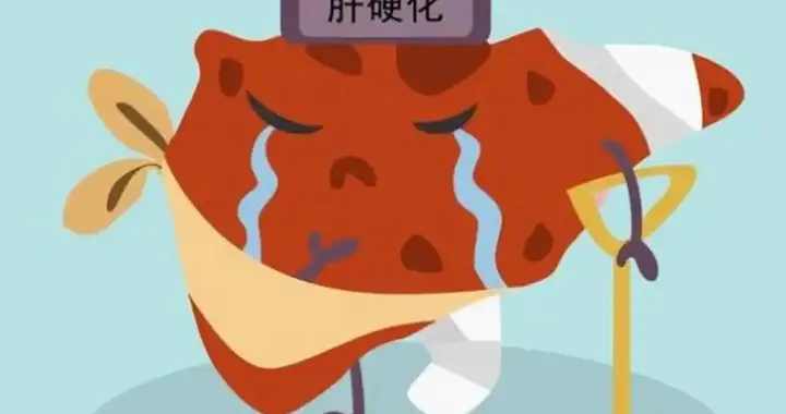 中国科学家立大功！借干细胞“修”漏水肝脏，硬化改善率达88.9%