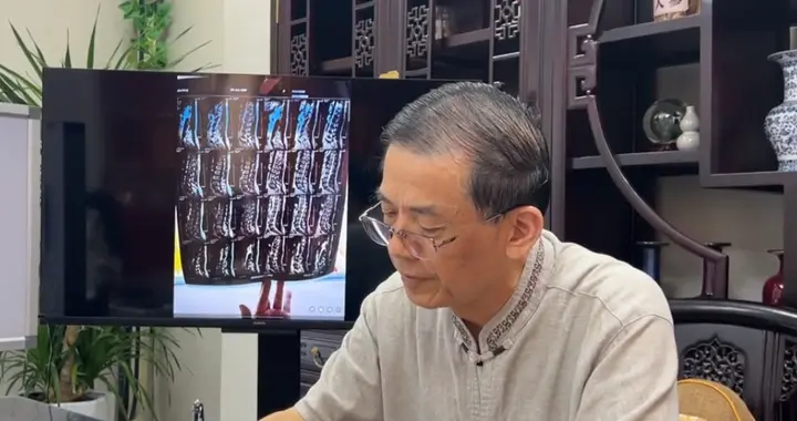腰突会不会瘫？老中医摆摆手：我干了40年，真正瘫的没几个