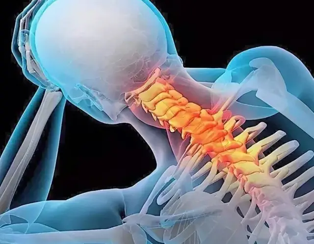 颈椎病用药组合：抗骨增生片联合万通筋骨片