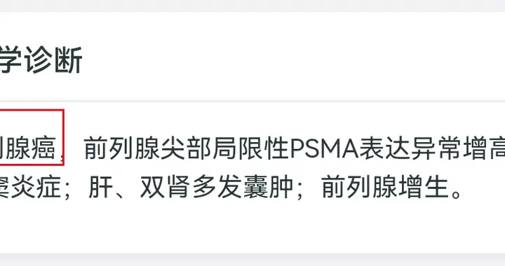 65岁前列腺癌，Gleason评分：4+5=9分——病理报告解读