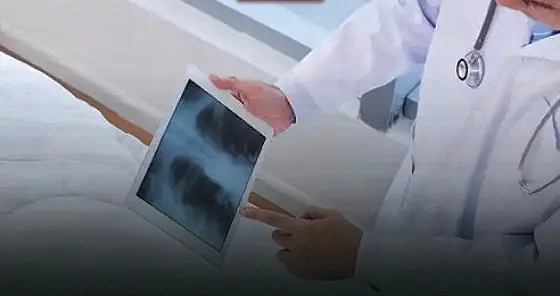 胸部CT检查报告出现哪几个提示词，一定要留意肺病恶化？