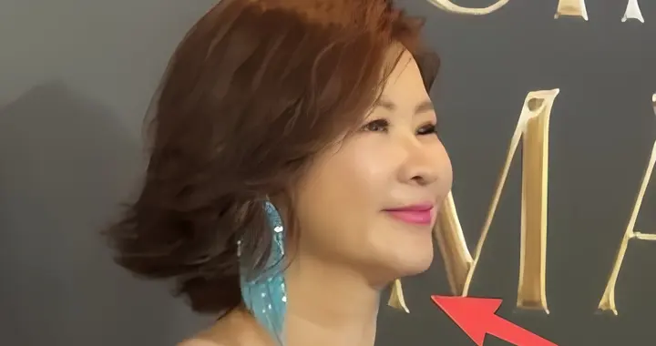 澳门盛典太真实，张雪迎“空杯”尴尬，杜华肿胀，天王嫂咋瘦成这