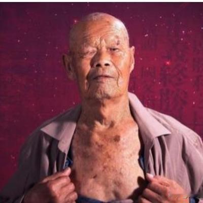 真相便利贴：1956年，35岁的农民咳嗽