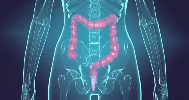 肠道里长了息肉，上厕所时会有4个提示，别等到肠癌了才反应过来