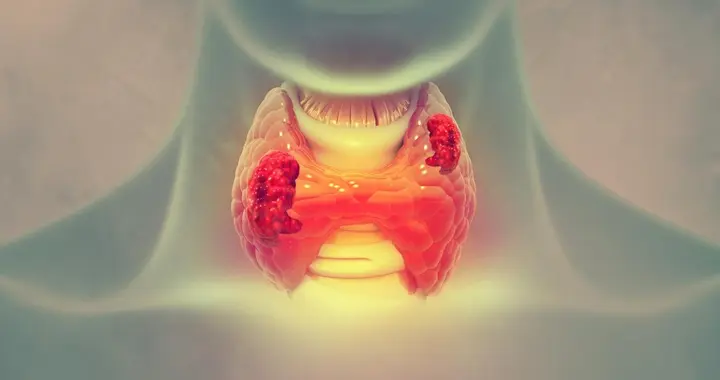 一家三口患上甲状腺癌，医生：出现5个信号别大意了