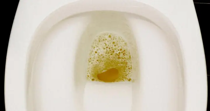 很快就肾衰竭！医生劝告：糖尿病患者若常出现5个症状，立即就医