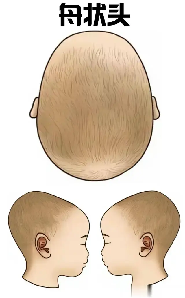 什么是舟状头？又该咋睡圆头？宝宝睡头型的真相，拒绝焦虑！
