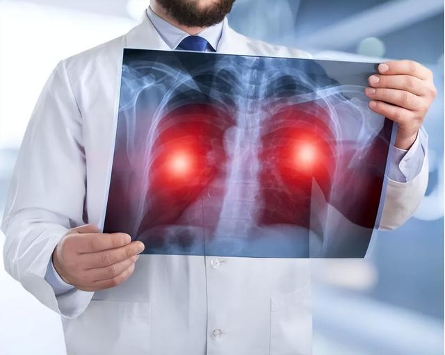 肺癌|肺癌来临并非不声不响，双腿出现2种异常，可能是肺癌到来