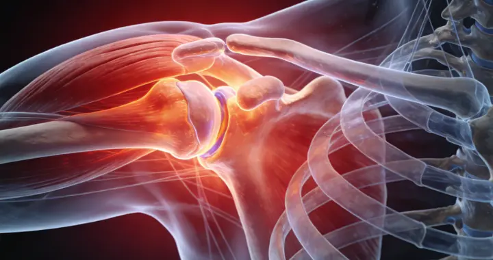 肩关节屈伸不利，肩周反复酸痛，一个中成药能舒缓各类不适