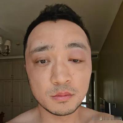 彩虹吃瓜娱乐：尼格买提晒照劝大家别染发