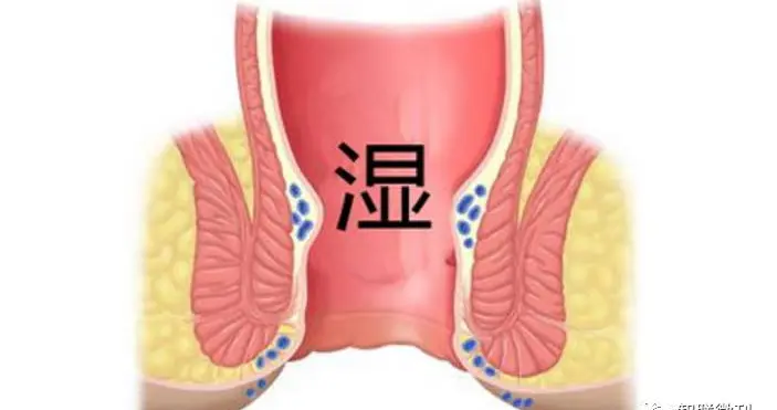 慢性前列腺炎，别乱用抗生素，这6个中成药配合使用，好得更快