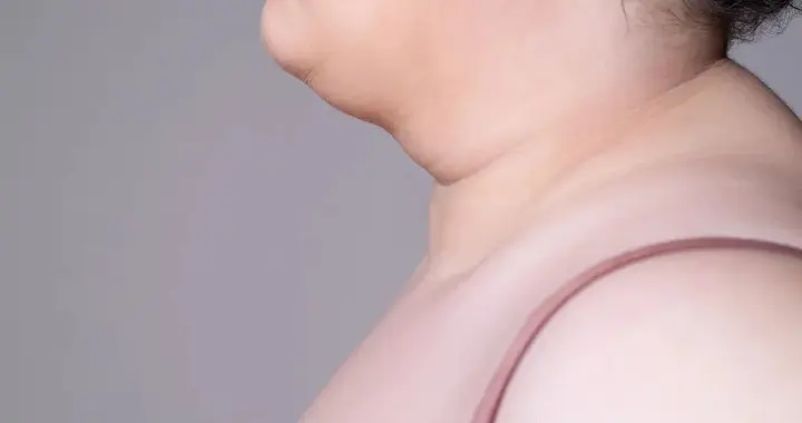 体重没涨脖子先粗？这个被忽视的指标，比腰围更危险
