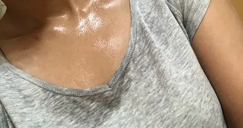 一吃饭头上就滴汗？你流的不是汗，是津液，是心液，是脾精