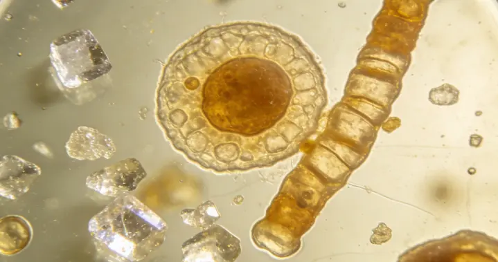 风湿科临床观察：病情稳定的狼疮患者，平日往往做好这几件事