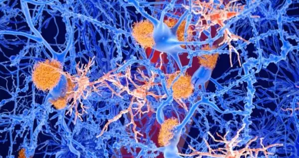 科学家研究新化合物可逆转大鼠的阿尔茨海默病症状