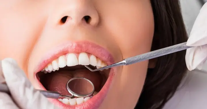 塞牙是病，不治可能要拔牙！出现这3个征兆千万别拖