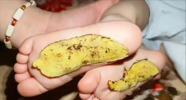 孩子鼻涕倒流，是阳气不够旺！5个小妙招，在三伏天把阳气"叫醒"