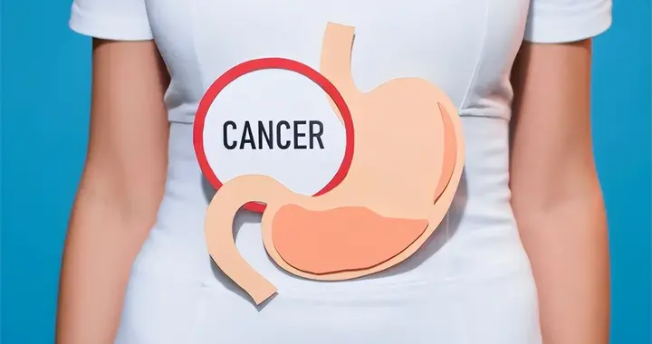 胃癌不痛不痒？医生提醒：如果出现这6个表现，建议尽早做胃镜！