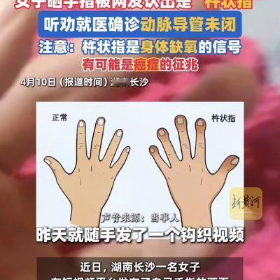 柠檬百香果：长沙女子晒钩织视频，被网友一