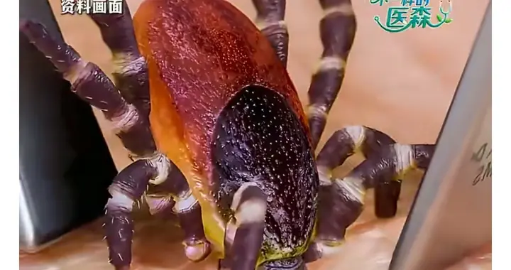 徒手拔蜱虫险酿祸！1岁娃病危给家长敲警钟