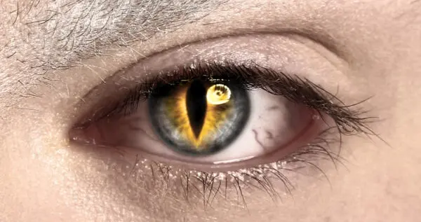 不正规的隐形眼镜可能会对你的眼睛造成严重伤害