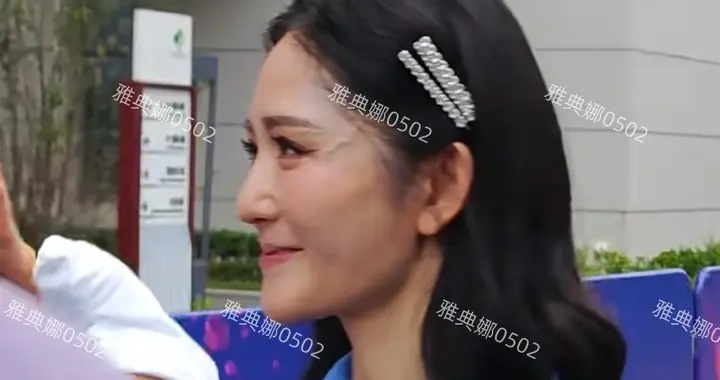 谢娜的脸怎么了？不仅下巴突出上翘眼周围更是青筋暴起近看很奇怪