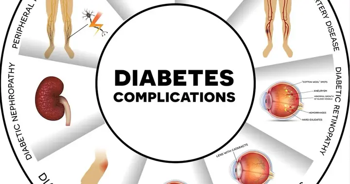 治疗糖尿病慢性并发症的3个经典中成药，一文总结