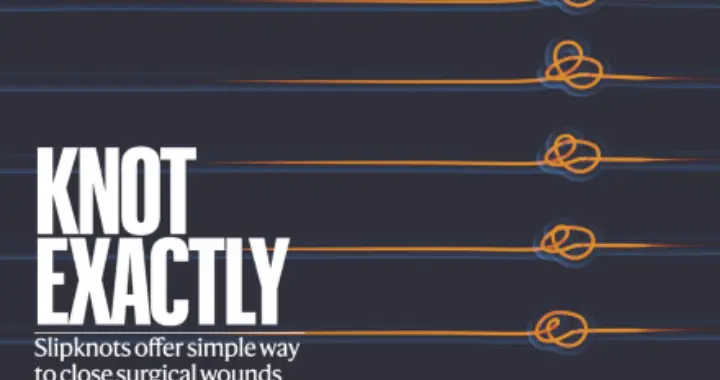 一个“活结”的智慧：浙大Nature发表封面论文，解决微创手术打结难题...